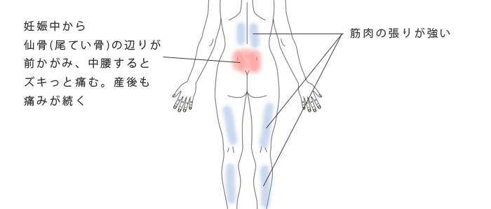 鍼･活法整体で改善した腰痛の治療例