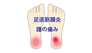 「踵の痛み」足底筋膜炎と診断